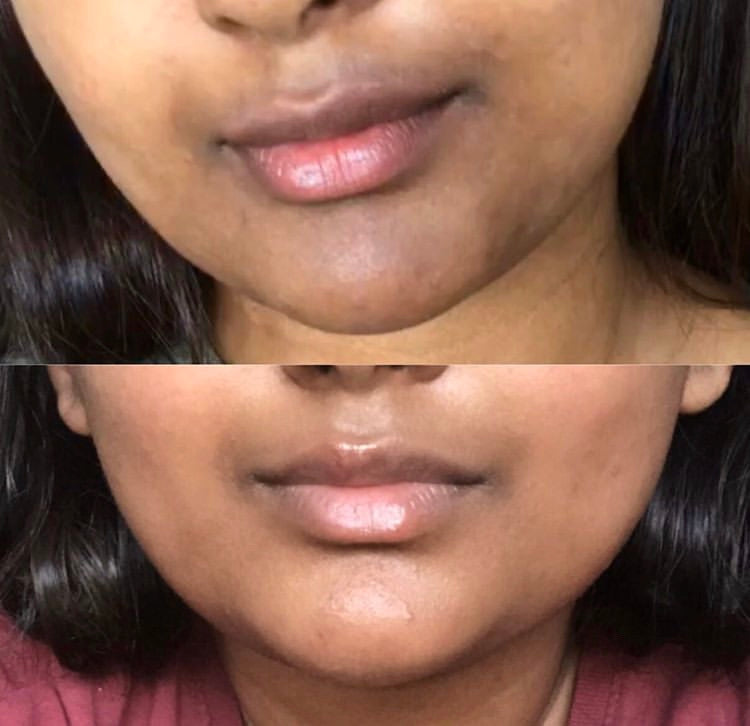 Rapid Recovery Glow Elixir Restoration Oil