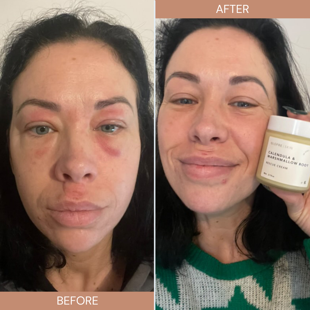 Calendula & Marshmallow Root Rescue Cream